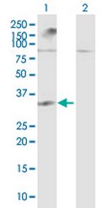 LGALS12 Antibody in Western Blot (WB)