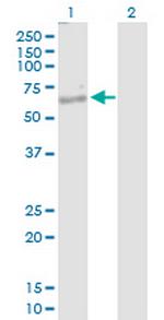 NKD1 Antibody in Western Blot (WB)