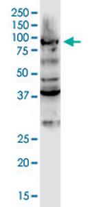 DCLK3 Antibody in Western Blot (WB)