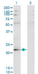 LBX2 Antibody in Western Blot (WB)