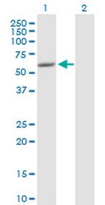 SCIN Antibody in Western Blot (WB)