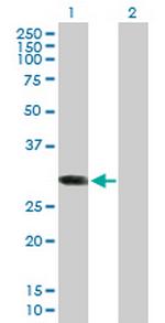 ABCC10 Antibody in Western Blot (WB)