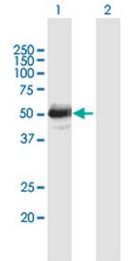 LHX4 Antibody in Western Blot (WB)