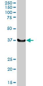 LHX4 Antibody in Western Blot (WB)