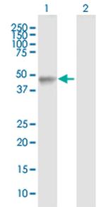 LHX4 Antibody in Western Blot (WB)