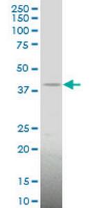 LHX4 Antibody in Western Blot (WB)