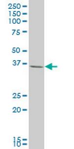 LHX4 Antibody in Western Blot (WB)