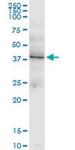 LHX4 Antibody in Western Blot (WB)