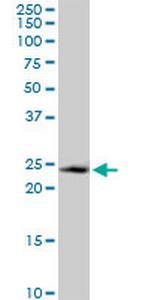 GADD45GIP1 Antibody in Western Blot (WB)