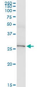 IL33 Antibody in Western Blot (WB)