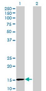 ZNF697 Antibody in Western Blot (WB)