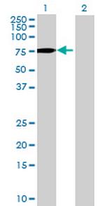 ACBD5 Antibody in Western Blot (WB)