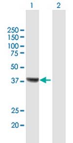 RSAD2 Antibody in Western Blot (WB)