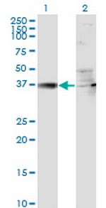 RSAD2 Antibody in Western Blot (WB)