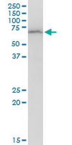 DEPDC7 Antibody in Western Blot (WB)