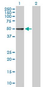 CHRDL1 Antibody in Western Blot (WB)