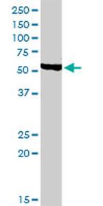 CHRDL1 Antibody in Western Blot (WB)