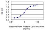 CHRDL1 Antibody in ELISA (ELISA)