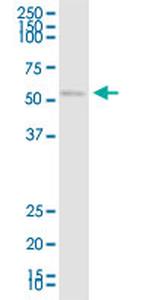 CHRDL1 Antibody in Western Blot (WB)