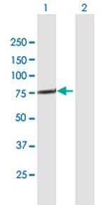 TTC30A Antibody in Western Blot (WB)