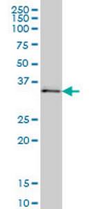 UBE2Q2 Antibody in Western Blot (WB)