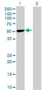 ADAMTSL1 Antibody in Western Blot (WB)