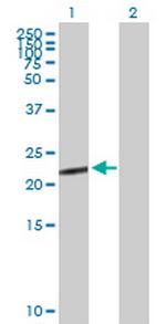 CGB5 Antibody in Western Blot (WB)