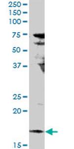 IL17F Antibody in Western Blot (WB)