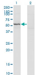 KRT71 Antibody in Western Blot (WB)