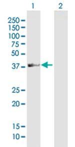 ADAT3 Antibody in Western Blot (WB)