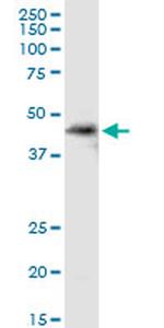 SDSL Antibody in Western Blot (WB)