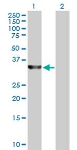 SDSL Antibody in Western Blot (WB)