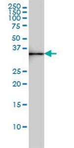 SDSL Antibody in Western Blot (WB)