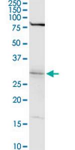 WBSCR22 Antibody in Western Blot (WB)