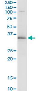 WBSCR22 Antibody in Immunoprecipitation (IP)