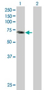 PALM2 Antibody in Western Blot (WB)