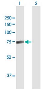 PALM2 Antibody in Western Blot (WB)