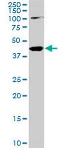 PALM2 Antibody in Western Blot (WB)