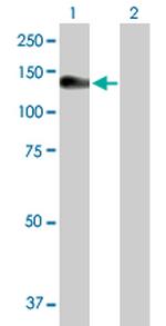 NLRP3 Antibody in Western Blot (WB)