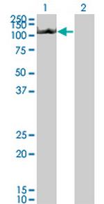 NLRP3 Antibody in Western Blot (WB)