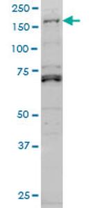 LMTK3 Antibody in Western Blot (WB)