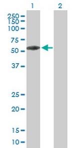 KBTBD9 Antibody in Western Blot (WB)