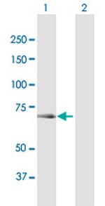 OSBPL6 Antibody in Western Blot (WB)