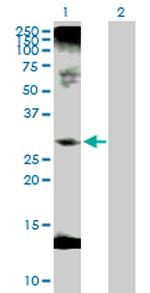 C1QTNF1 Antibody in Western Blot (WB)