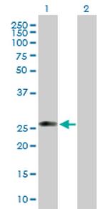 C1QTNF5 Antibody in Western Blot (WB)