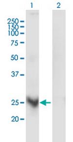 MARCH3 Antibody in Western Blot (WB)