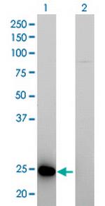 RAB39B Antibody in Western Blot (WB)