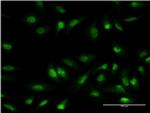 OLIG1 Antibody in Immunocytochemistry (ICC/IF)