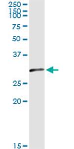 OLIG1 Antibody in Immunoprecipitation (IP)