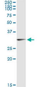 OLIG1 Antibody in Immunoprecipitation (IP)